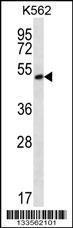 Anti-MORN1 Rabbit Polyclonal Antibody (Biotin)