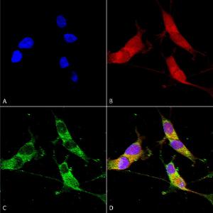 Immunocytochemistry/Immunofluorescence analysis of human neuroblastoma cells (SH-SY5Y), fixed in 4% PFA for 15  min, using Anti-VGLUT2 Antibody [S29-29] (A305012), at 1:50 for overnight at 4 °C with slow rocking.