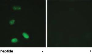 Anti-MYB Rabbit Polyclonal Antibody