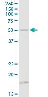 Anti-TUBB Rabbit Polyclonal Antibody