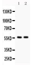 Anti-KIAA0652 Rabbit Polyclonal Antibody