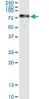 Anti-TYRP1 Rabbit Polyclonal Antibody