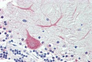 Anti-TRIM71 Antibody (A84789) (3.75 µg/ml) staining of paraffin embedded Human Cerebellum. Steamed antigen retrieval with citrate buffer pH 6, AP-staining