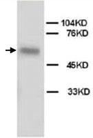 Anti-ALPL Rabbit Polyclonal Antibody