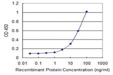 Anti-PKHD1L1 Mouse Monoclonal Antibody [clone: 1F5]