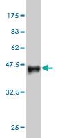 Anti-EPM2A Mouse Monoclonal Antibody [clone: 6C6]