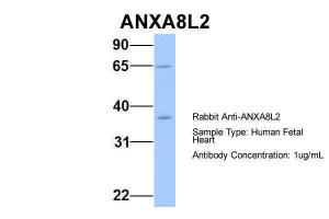 Anti-ANXA8L2 Rabbit Polyclonal Antibody