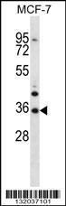 Anti-MORN3 Rabbit Polyclonal Antibody (AP (Alkaline Phosphatase))