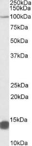 Anti-TRIM71 Antibody (A84790) (0.5 µg/ml) staining of NIH3T3 lysate (35 µg protein in RIPA buffer). Primary incubation was 1 hour. Detected by chemiluminescence