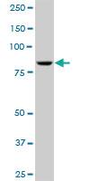 Anti-ADARB1 Mouse Polyclonal Antibody