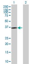 Anti-HOXD1 Rabbit Polyclonal Antibody