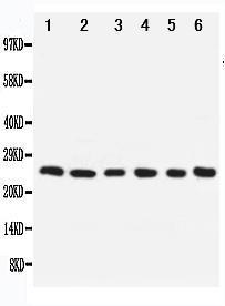 Anti-Apoptosis repressor with CARD Rabbit Polyclonal Antibody