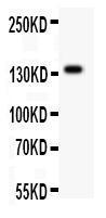 Anti-ATX2 Rabbit Polyclonal Antibody