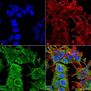 Anti-AMIGO1 antibody