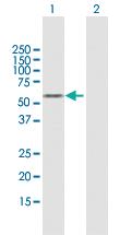 Anti-KLF5 Mouse Polyclonal Antibody