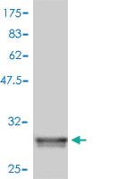 Anti-ZDHHC8 Mouse Polyclonal Antibody