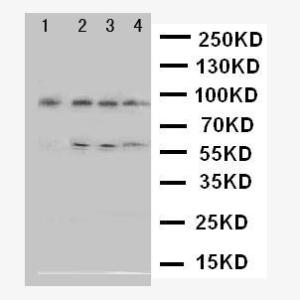 Anti-ADAM17 Rabbit Polyclonal Antibody