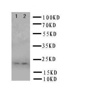 Anti-Prion protein PrP Rabbit Polyclonal Antibody