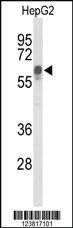 Anti-ITPKC Rabbit Polyclonal Antibody