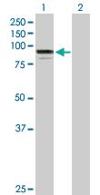 Anti-ADARB1 Mouse Polyclonal Antibody