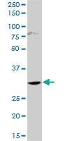 Anti-HOXD1 Rabbit Polyclonal Antibody