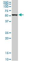 Anti-TUBB Rabbit Polyclonal Antibody