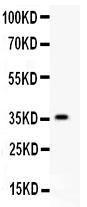 Anti-HIF-1-Alpha Polyclonal Antibody