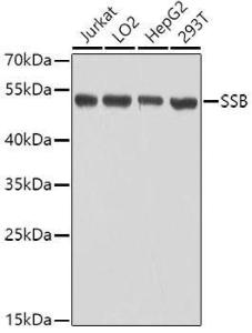 Anti-SSB antibody