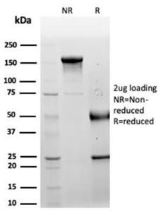 SDS-PAGE analysis of Anti-LRG1 Antibody [LRG1/4882] under non-reduced and reduced conditions; showing intact IgG and intact heavy and light chains, respectively SDS-PAGE analysis confirms the integrity and purity of the antibody