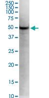 Anti-KLF5 Mouse Monoclonal Antibody [clone: 2G12]