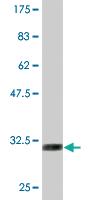 Anti-SLC2A4 Mouse Monoclonal Antibody [clone: 2A4]