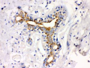 Anti-ATX2 Rabbit Polyclonal Antibody