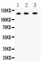 Anti-HIF-1-Alpha Polyclonal Antibody