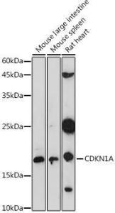 Western blot analysis of extracts of various cell lines, using Anti-p21 Antibody (A307811) at 1:1,000 dilution. The secondary antibody was Goat Anti-Rabbit IgG H&L Antibody (HRP) at 1:10,000 dilution.