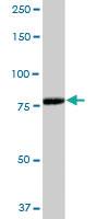 Anti-ADARB1 Mouse Polyclonal Antibody