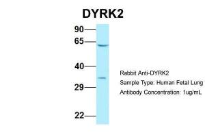 Anti-DYRK2 Rabbit Polyclonal Antibody