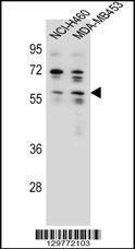 Anti-ANKRD34C Rabbit Polyclonal Antibody (Biotin)