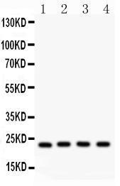 Anti-BAK Rabbit Polyclonal Antibody