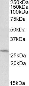 Anti-DCUN1D1 Antibody (A84792) (0.5 µg/ml) staining of HepG2 lysate (35 µg protein in RIPA buffer). Primary incubation was 1 hour. Detected by chemiluminescence