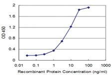 Anti-KLF5 Mouse Monoclonal Antibody [clone: 2G12]