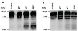 Anti-ITGB2 Mouse Monoclonal Antibody [clone: MEM-148]