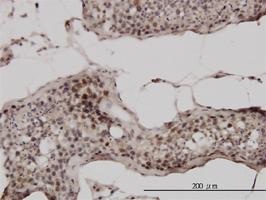 Anti-UBB Mouse Monoclonal Antibody [clone: 1F5]