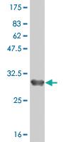 Anti-ZDHHC8 Mouse Monoclonal Antibody [clone: 1C5]