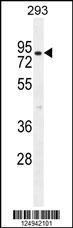 Anti-CLPX Rabbit Polyclonal Antibody (APC (Allophycocyanin))