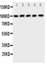 Anti-CBL Rabbit Polyclonal Antibody