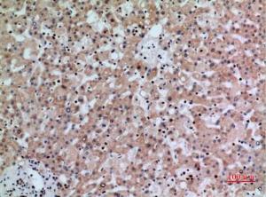 Immunohistochemical analysis of paraffin-embedded human liver using Anti-IFNGR1 Antibody