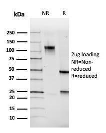 Antibody anti-PAX5 PAX53735 BSA 100 µg