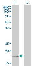 Anti-BTF3 Mouse Monoclonal Antibody [clone: 3C4-2E11]