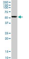 Anti-TUBB Rabbit Polyclonal Antibody