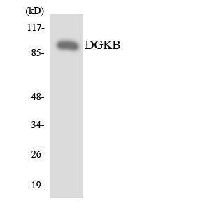 Western blot analysis of the lysates from HUVEC cells using Anti-DGKB Antibody